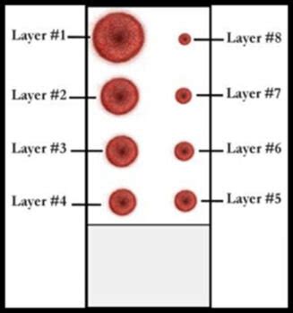 live blood drop test|Live and Dry Blood Analysis .